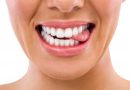 Smart strategies to reduce your dental expanses