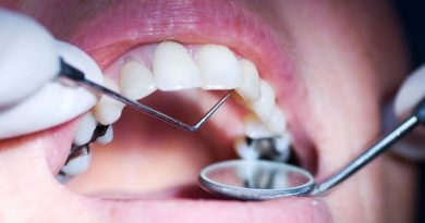 What happens if you don’t fill in cavities?